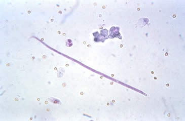Onchocerca cervicalis (Horse worm)